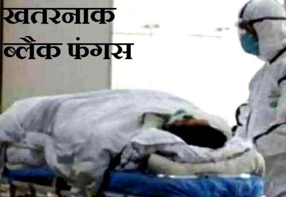 ब्लैक फंगस: भिलाई में मिले 6 नए मरीज, BSP कर्मचारी की जान बचाने डॉक्टरों को काटनी पड़ी नाक