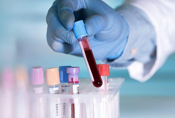 pathology जिले की 26 निजी पैथोलॉजी लैब की हुई जांच, रिपोर्ट के आधार पर होगी कार्यवाही