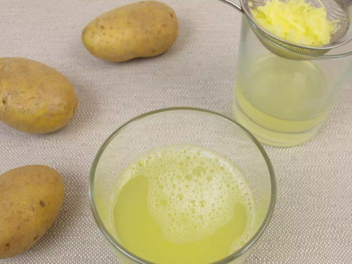 If you are troubled by these hair problems then potato and kiwi are beneficial, use this way