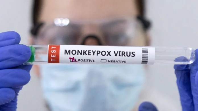 अब तक 16 देशों में मिल चुके Monkeypox के 220 मरीज, भारत में संक्रमण को लेकर केंद्र ने जारी की चेतावनी !
