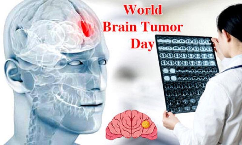 World Brain Tumor Day : बुजुर्ग के साथ युवा भी हो रहे ब्रेन ट्यूमर के शिकार! यहां हर महीने आते हैं 20 से 30 मरीज