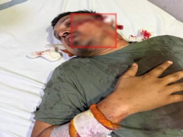 रायपुर केंद्रीय जेल में भूपेश बघेल के समर्थक आशीष शिंदे पर हुआ हमला, अस्पताल में किया गया दाखिल