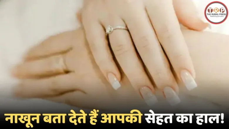 Health warning signs through fingernails color change