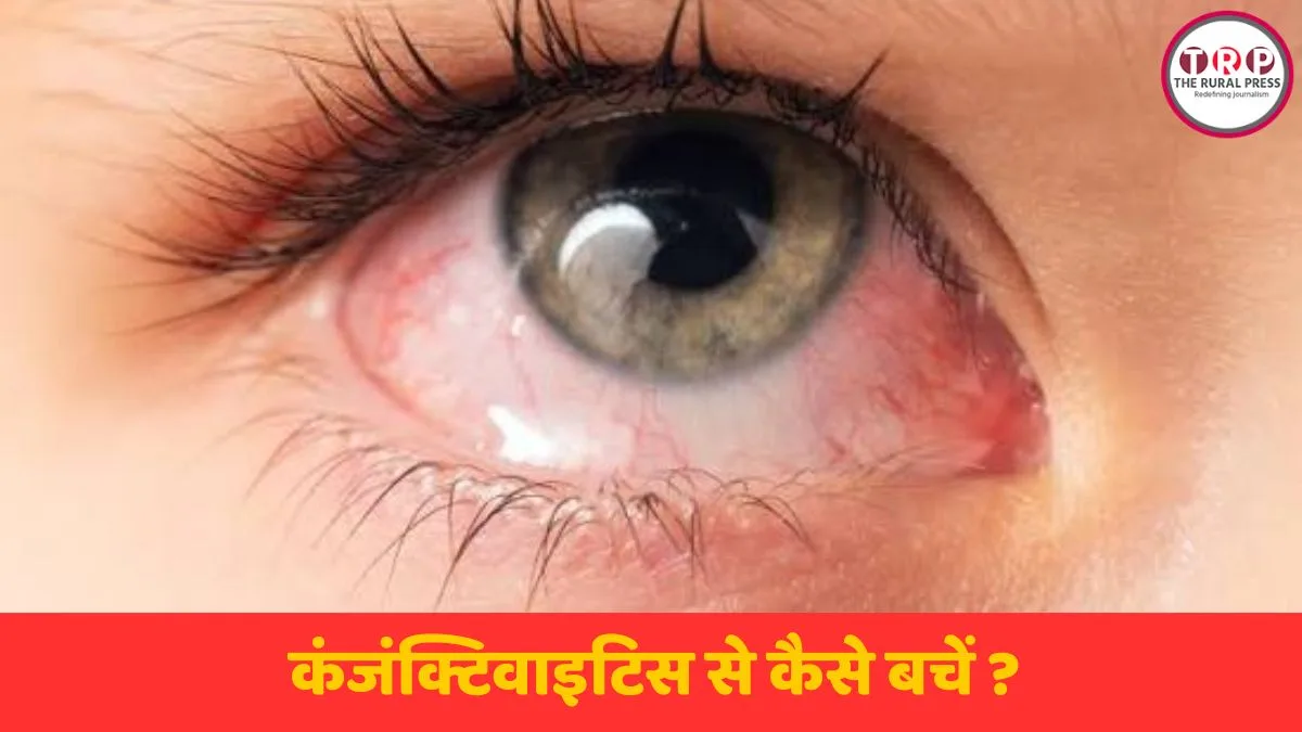 मानसून में कंजंक्टिवाइटिस या पिंक आई संक्रमण से पीड़ित व्यक्ति अपनी आंखों की देखभाल करता हुआ