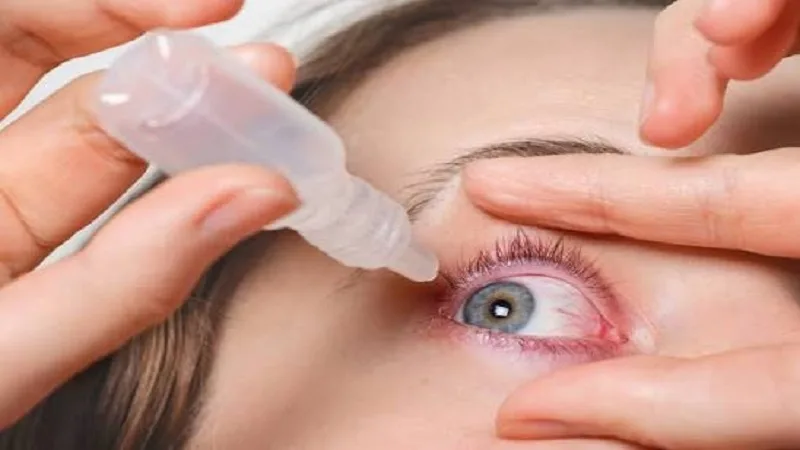 Pink eye conjunctivitis prevention tips during monsoon