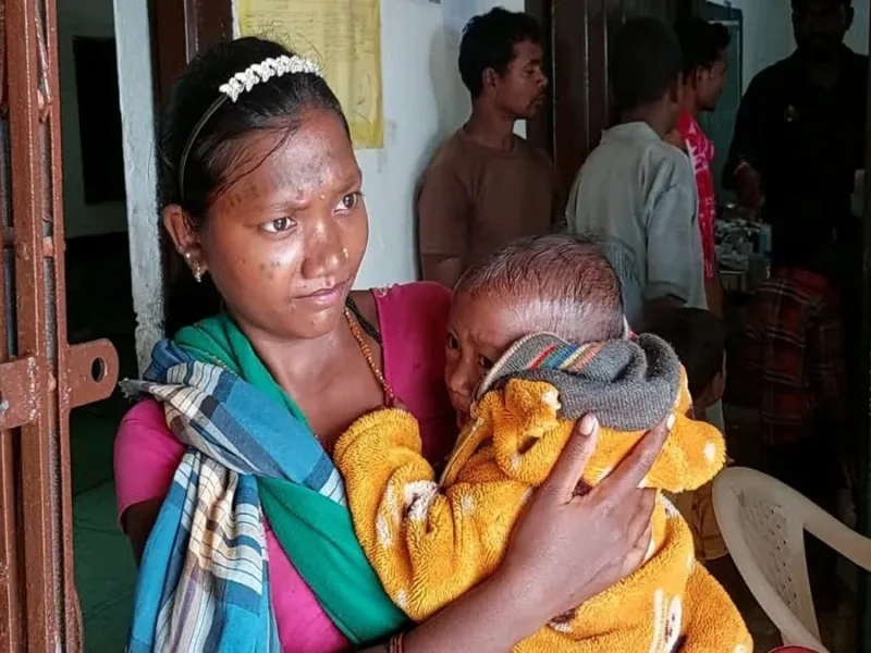 Baiga tribal children receiving treatment at a hospital in Balaghat Madhya Pradesh