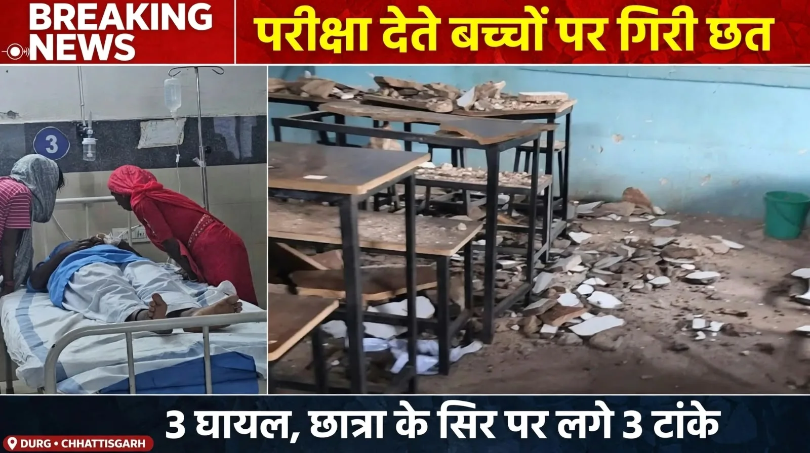 Durg: परीक्षा दे रहे थे बच्चे, अचानक गिरा स्कूल की छत का प्लास्टर, 3 छात्र घायल