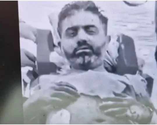 Captain Smit Machchhar First Video: फ्लाईदुबई हमले के बाद कैप्टन स्मित मच्छार का पहला वीडियो आया सामने, स्ट्रेचर पर दिखे घायल पायलट, जानें कैसी है हालत