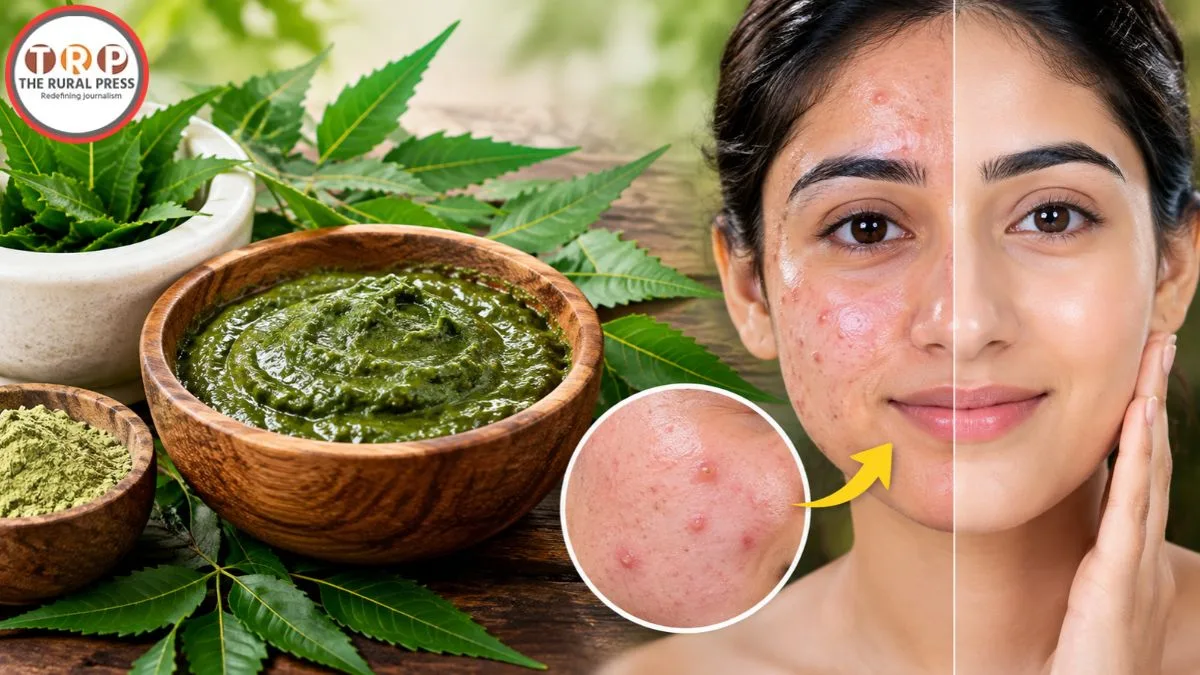 Neem Face Wash at Home: चेहरे के पिंपल्स और ऑयली स्किन से राहत देगा नीम का यह होममेड पेस्ट, जानें सही तरीका