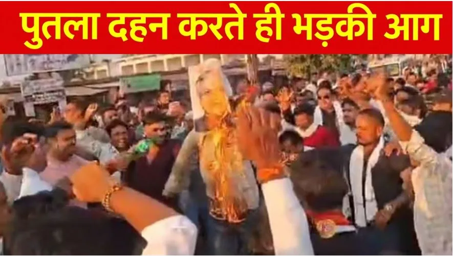 Bemetara: पुतला दहन के दौरान भड़की आग, झुलस गए कई कांग्रेस नेता, जानिए किन मुद्दों पर कर रहे थे प्रदर्शन